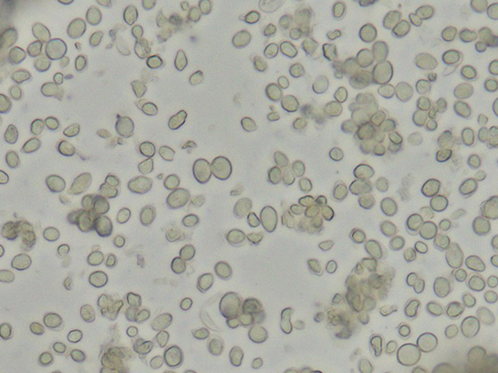 ビール酵母原料（死菌）の顕微鏡写真